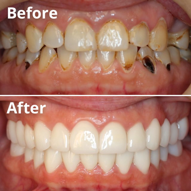 Smile Gallery