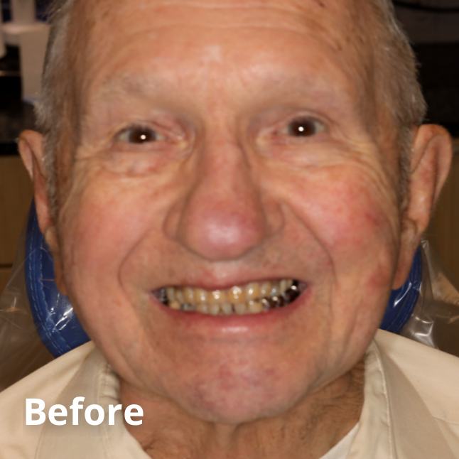 Before Teeth