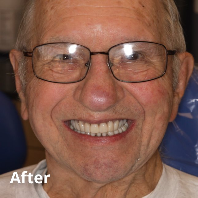 After Teeth